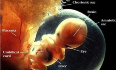 Baby-in-the-womb